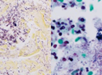 Image: Gram positive and Gram-negative bacteria with green counterstain stained using VENTANA Gram Staining Kit on the BenchMark Special Stains automated staining platform (Photo courtesy of Ventana Medical systems, Inc.).